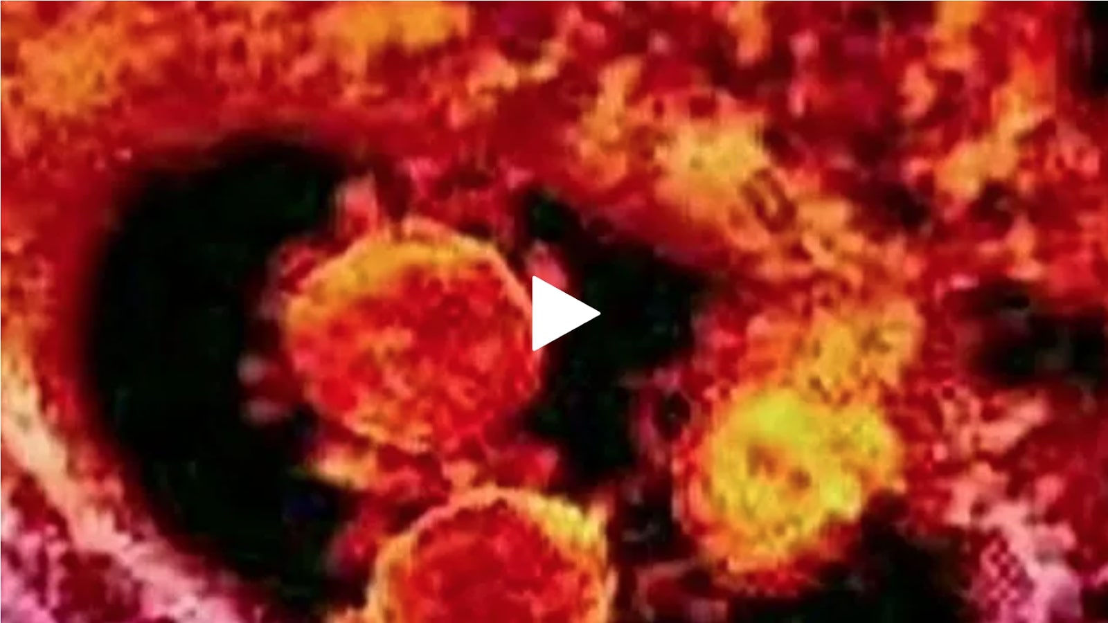 Fox News Protecting America from MERS and other biological threats